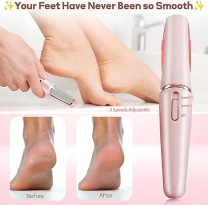 Rechargeable Electric Foot File – Callus Remover for Soft Smooth Feet